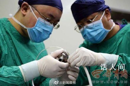 全國首例心臟不停跳人工心臟植入 手術成功