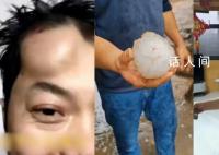 河北多地遭強對流天氣:冰雹如拳
