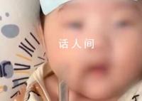 嬰兒被親友輪番親吻高燒近40度 就醫后孩子被診斷為病毒感染
