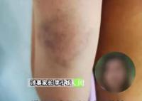 教師體罰學生被開除44名家長挽留 老師確實得到了同事和學校的認可