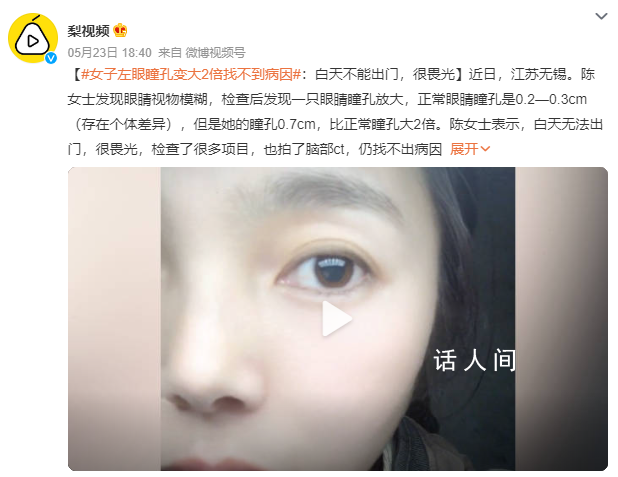 女子左眼瞳孔變大2倍找不到病因 白天無法出門很畏光