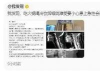 姑娘嗓子疼從就診到去世僅10分鐘 急性會厭炎是什么