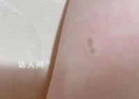 多人稱被蘋果充電頭電傷 引發(fā)了網(wǎng)友的關(guān)注和討論