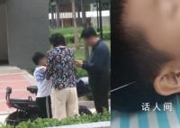 男童踢球撞到大媽被打致住院 家長已經報警處理