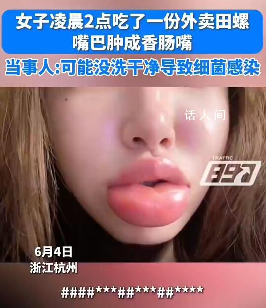 女生半夜嗦田螺腫成香腸嘴 當時以為是辣的