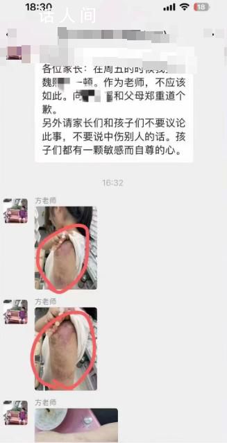 官方通報老師打?qū)W生獲家長感謝 引起被打女生家長的不滿和質(zhì)問