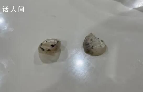 異物是鴨眼鞏膜?記者解剖多個鴨頭