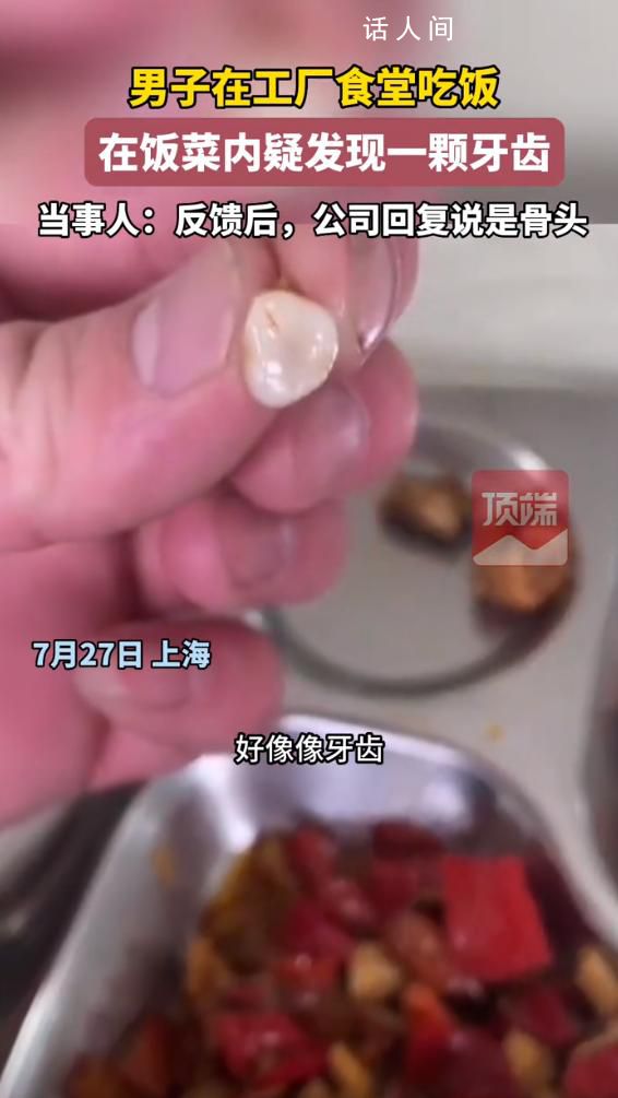 男子稱在公司食堂疑似吃出牙齒 此事引發(fā)關(guān)注
