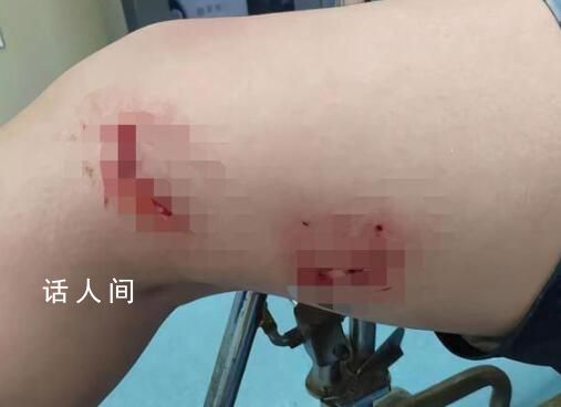 不明魚類咬游客 有人掰開魚嘴才擺脫