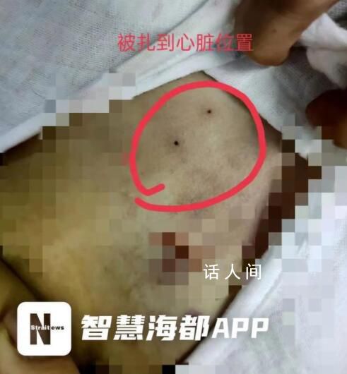 醫(yī)院回應(yīng)穿刺失誤致女童死亡 正在走司法途徑