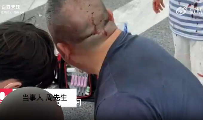 兒子被撞送醫(yī)途中車禍致女兒身亡 認為贛州黃金機場對此事有不可推卸的責任
