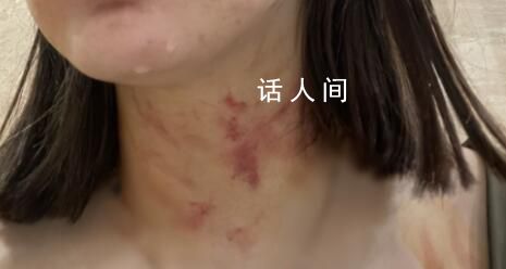 女子遭夫妻扒衣掐脖?警方介入