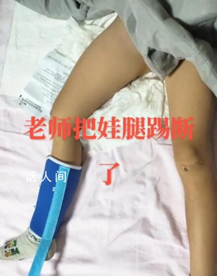 陜西一學(xué)生被老師踢斷腿骨?官方回應(yīng)
