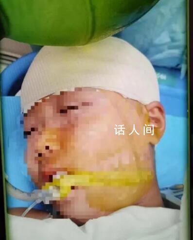 被打破頭骨女生已清醒?家屬回應