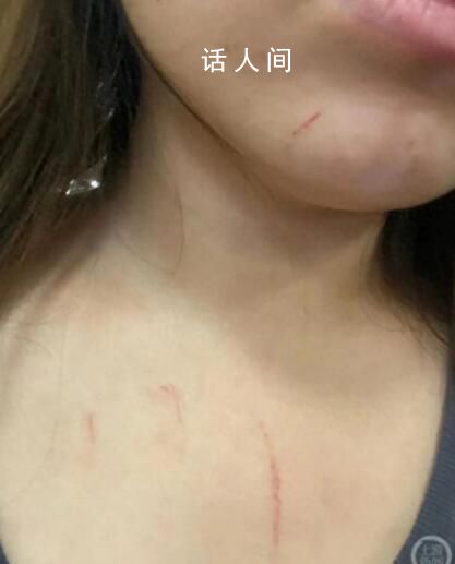 女子高鐵拒換座遭毆打 警方通報(bào)
