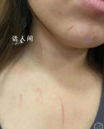 高鐵拒換座被打女子:對(duì)方先動(dòng)手