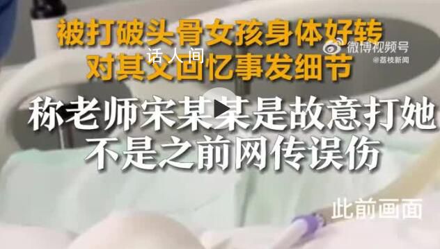 被打破頭骨女孩:老師故意打我