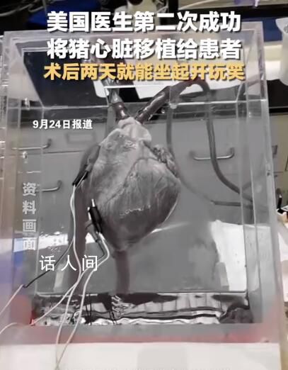 美國醫生再次將豬心臟移植給患者 目前患者仍處于觀察期恢復較好