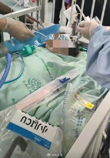 被狗咬傷女童已籌齊200萬捐款 女童目前處于昏迷狀態
