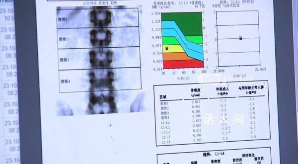 女子每天3杯咖啡被確診骨質疏松 你喜歡喝咖啡嗎