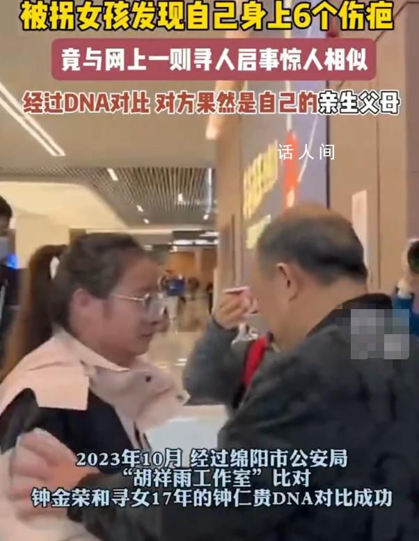 女孩身上6個傷疤同尋人啟事一致 沒想到世界的另一頭果然有人在等我