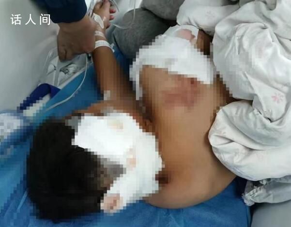 被狗咬傷男童已出ICU:耳朵缺一塊