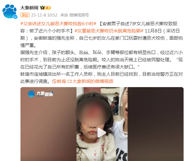 安徽7歲女童被惡犬撕咬致毀容 目前當地警方正在對此事進行調查