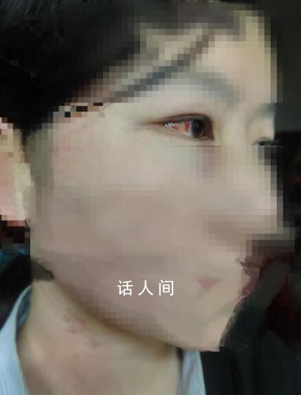 懸賞找打人者事件3人已被抓 均為未成年