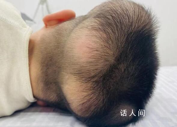 5歲男童患“超級(jí)罕見病” 頭部及身體多處長腫瘤