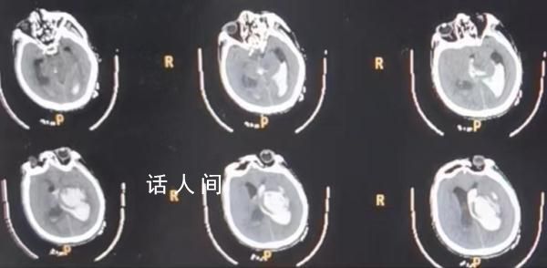 男子喂豬時暈倒 遭家豬啃食下半身