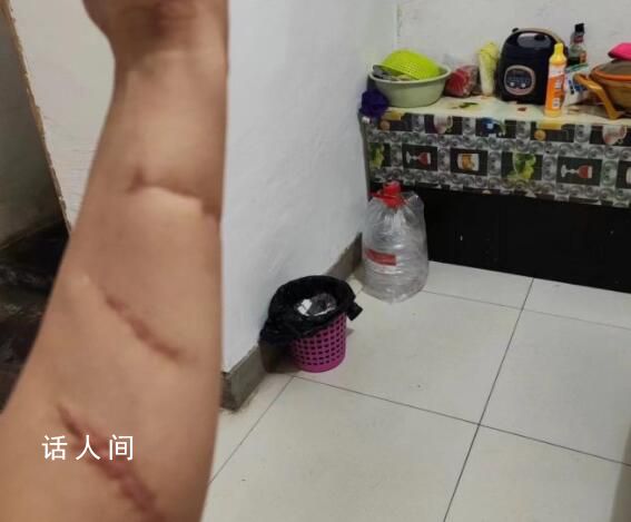 女子為保護室友被砍傷 室友家屬回應