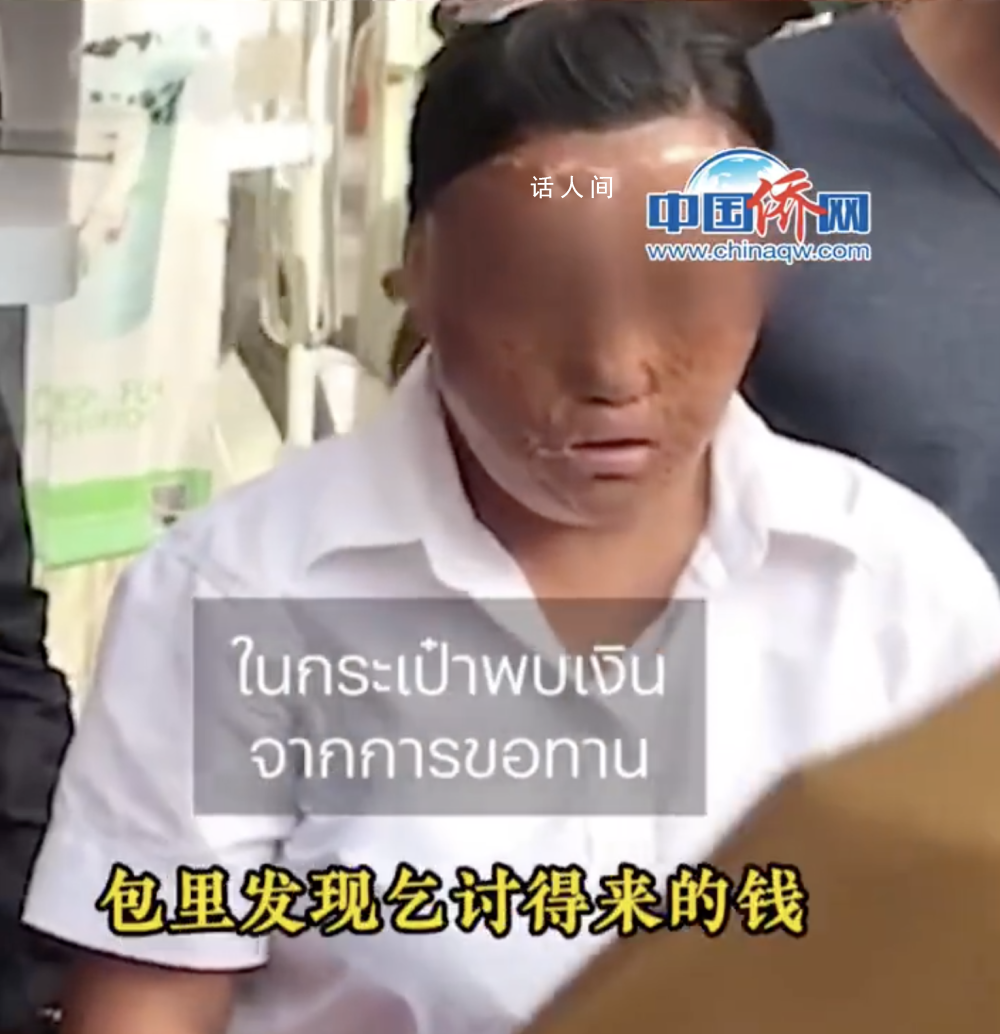 泰媒:曼谷現多名中國籍毀容乞討者