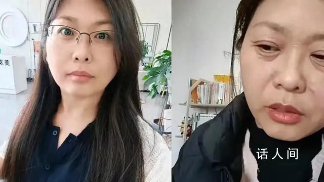 42歲女子20天斷崖式衰老 女子的臉部皺紋增多