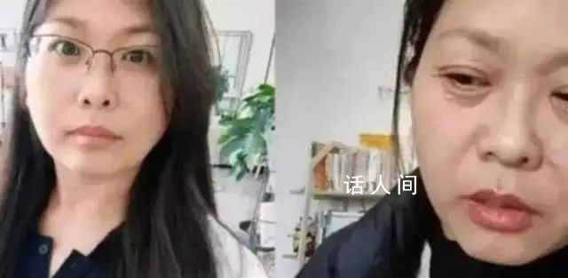 女子自稱20天內(nèi)“老了30多歲” 看上去像七十多的
