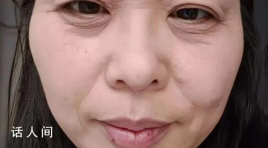 斷崖式衰老女子本以為能漂亮過余生 沒想到來這么當頭一棒