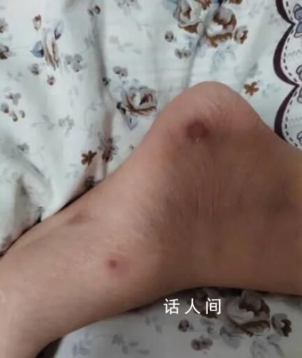 家長稱學校無取暖設施孩子手腳凍爛 學校目前處于停課狀態
