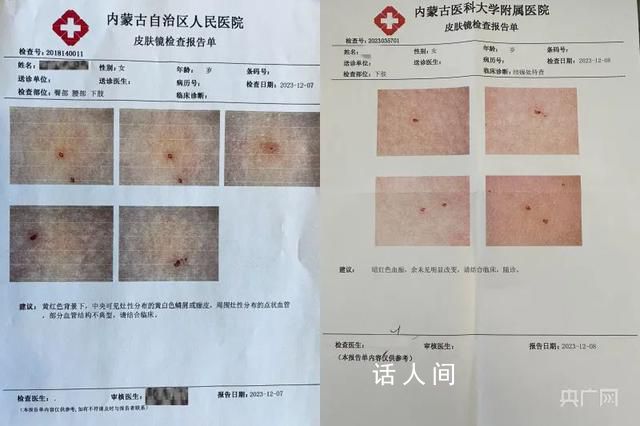 媒體:女童被扎事件須盡快給個交代