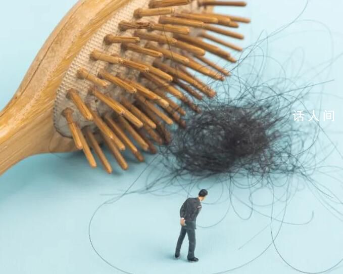 3D打印或?qū)⒄让摪l(fā) 脫發(fā)有救了