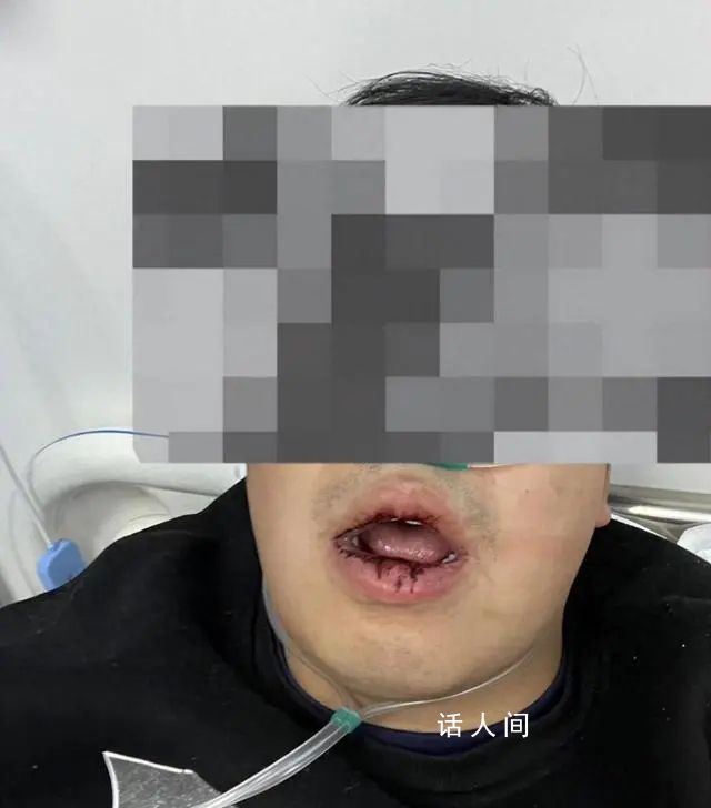 小伙群內(nèi)罵物業(yè)被多人上門扇嘴巴 物業(yè)上門后雙方發(fā)生爭(zhēng)執(zhí)