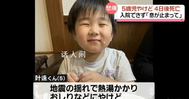日本燙傷男孩遭醫(yī)院拒收后發(fā)燒去世 孩子走時臉色變成青白色