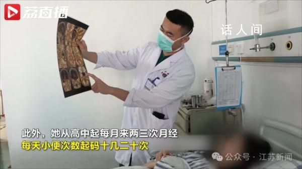 女生每月3次月經 腦部查出垂體瘤