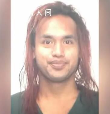 在美被潑液體中國女子或永久毀容 身體大部分部位被燒傷