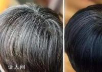 白頭發(fā)可能是身體給你的警報(bào) 白發(fā)的生長(zhǎng)位置標(biāo)志著體內(nèi)臟腑的健康狀態(tài)
