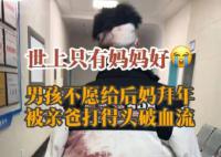 男孩不愿給后媽拜年 被親爸打破頭