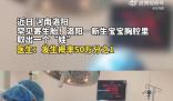 河南醫生成功分離罕見胎中胎 手術后的男嬰身體狀況良好