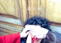 意大利警察毆打挺巴學(xué)生 一名女子因警方毆打而眼部受傷