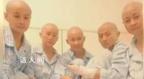 姐弟燒傷四位姨媽剃光頭捐頭皮 目前起火原因仍無定論