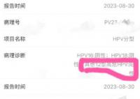 歌手滿舒克被曝致多位女生感染HPV 錄音對(duì)話曝光