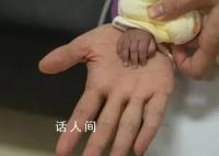 出生時僅650克的巴掌女嬰出院了 終于和媽媽一起回到了家里