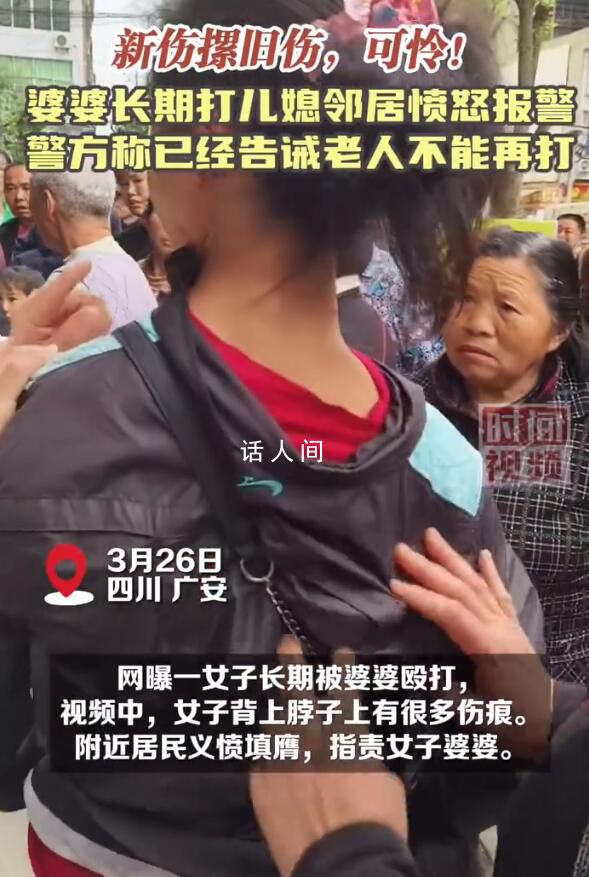 婆婆將兒媳打得滿身疤痕 鄰居報警